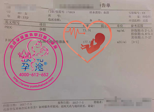 Z女士3次不明原因胎停,泰国第三代试管助孕圆梦