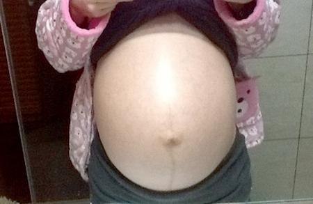 老公感染了艾滋病，为了宝宝健康，果断选择泰国试管婴儿洗精术