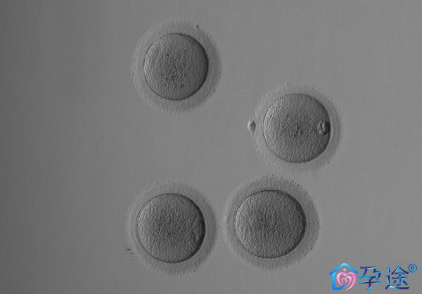 38高龄女泰国试管婴儿冻卵之路:冻卵流程及费用分享